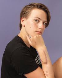 Cicatrici, il progetto fotografico