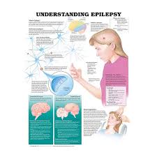 09 31 9867 Understanding Epilepsy Chart