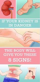 8 Early Warning Signs Your Kidneys Aren T Working As Well As They Should With Images Health Body Health Tips