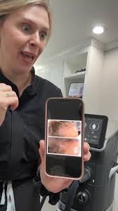 ✨ Start your hair restoration journey today! ✨, See Nurse Practitioner  Injector Amber Taylor’s results after just ONE session 👏 This is with the  FOLIX Laser, an FDA-approved device for hair ...