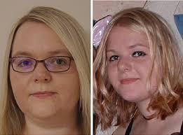 The effect of facial ageing