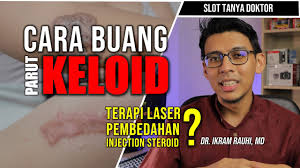 Penting bagi anda untuk menjaga kebersihan lingkungan dan juga tidak melakukan kontak dengan orang yang terkena kudis. Cara Buang Keloid Pembedahan Atau Suntikan Kortikosteroid Cara Hilangkan Parut Keloid Youtube