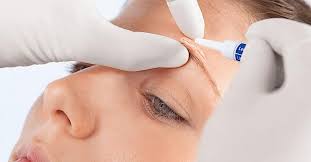 Reparacion De Heridas Mediante Pegamento Biologico En Que Consiste Faros Hsjbcn