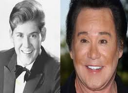 Botched Plastic Surgery Wayne Newton Plastic Surgery Before And After Facelift Eyelid And Wayne Newton Plastic Surgery Plastic Surgery Wayne Newton