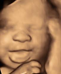 Laughing Ultrasound Baby Image