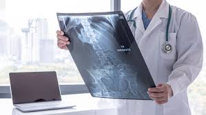 Your red blood cell levels may drop, causing anemia. Bone Cancer Symptoms Causes Risk Factors Diagnosis Treatments Cloudhospital
