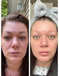 SILK primer sale for smooth skin and wrinkle reduction