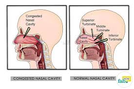 And knowing what's causing her runny or stuffy. Get Rid Of Stuffy Nose Stuffy Nose Remedy Stuffy Nose Cold And Cough Remedies