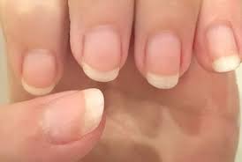 Endlich Lange Und Gesunde Fingernagel Miracle Nails Super Nagelharter Haare Und Nagel Gesunde Nagel Nails