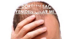 Sac Derdine Etkili Cozum Isirgan Otu Youtube