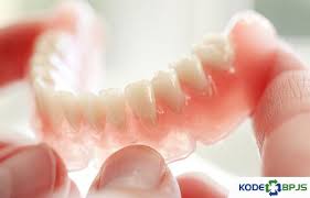 Audy dental adalah klinik gigi spesialis terbesar terpercaya di indonesia. Harga Gigi Palsu Di Puskesmas 2021 Permanen Lepasan Kodebpjs