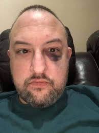 Pit bulls protect owner from attackers