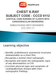 7 how much is a dot physical at cvs? Chest X Ray Presentation Cvs Atrium Heart Heart