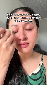 Voltou a minha autoestima… nem a minha dermatologista acreditou quando  disse!!!! 🙌🏻🙌🏻🥰 #olheiras #manchas #clareador