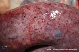 Image result for Glanders