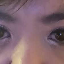 We did not find results for: What Can Be Done For Asian Eyelids That Flip And Move Into Different Crease Positions Depending On The Day Photos