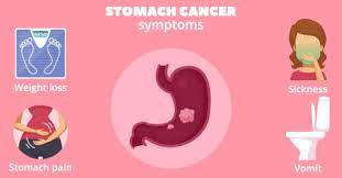 The common signs of stomach cancer that a patient experiences include: Stomach Cancer Signs Symptoms Of Early Final Stages