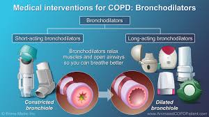 Image result for Medications in COPD Management