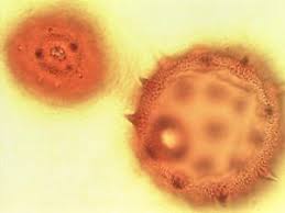 Image result for Dombeya shupangae