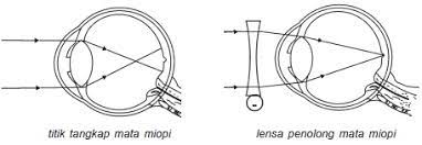 We did not find results for: Jenis Jenis Cacat Mata Penyebab Dan Cara Mengatasinya