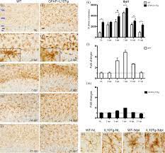 Astrocyte Targeted Il 10 Production Decreases Proliferation And Induces A Downregulation Of Activated Microglia Macrophages After Ppt Recasens 2019 Glia Wiley Online Library