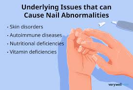 Image result for Nail Pitting