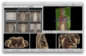 Anatomy Software Vh Dissector For Medical Education Touch Of Life Technologies Toltech Training