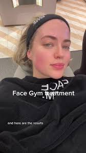 Had my dream treatment today at @FaceGym! I had the signature hands tr...