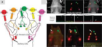 Lymph node cancer is often caused by cancer spreading to the area from another part of the body. Figure 7 Quantum Dot Based Simultaneous Multicolor Imaging Springerlink