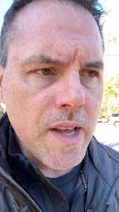 Malpractice Trial Begins Against Atlanta Dermatologist Over Botched Skin  Cancer Diagnosis