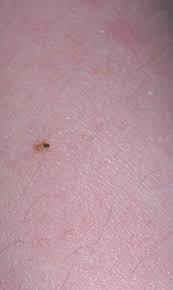 how to identify bedbugs and distinguish them from other pests bed bug bites bed bugs small bed