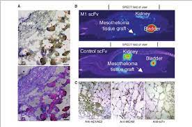 Check spelling or type a new query. Anti Mcam Scfv Targets Human Mesothelioma Tissue Fragments Ex Vivo And Download Scientific Diagram