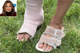 Mariska Hargitay Reveals She Broke Her Right Ankle: 'Summer Look'