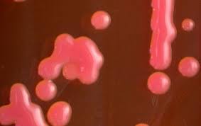 Image result for Rhizobium radiobacter, syn. Agrobacterium tumefaciens