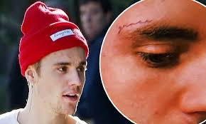 Although its popularity seems to be relatively recent, the art of permanent. Justin Bieber And The Riddle Of The New Tattoo Grace Eyebrow Ink Disappears On Outing Daily Mail Online