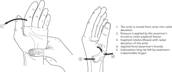 Image result for Scaphoid Shift Test