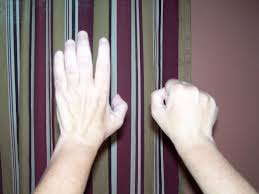 My Hands Again I Have Cmt 1a And I Am Unable To Straighten My Right Hand If My Hands Are Resting On Top Of A Table Or Somethin Teeth Diseases Teeth Disease