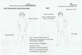 Are you the kind of person who says. Changes In Self Perception Following Breast Cancer As Expressed In Self Figure Drawings Present Past Sciencedirect