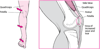 Think of the front leg as the 'working leg' and the back leg as the 'supporting' leg. Pain In The Front Of The Knee Injuries And Poisoning Merck Manuals Consumer Version