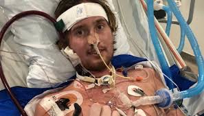 Carter Parry: ricomincio dal surf, senza una gamba e un polmone