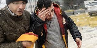 Berkin elvan'ın ailesinin yönettiği @berkin_elvan hesabından berkin'in sağlık durumuna ilişkin twitter üzerinden açıklama yapılmaya devem ediliyor. Hastanede Berkin Elvan I Bekleyenlere Biber Gazli Mudahale 1 Yarali Var