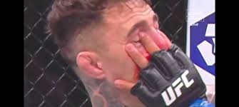 MMA fight analysis and opinion