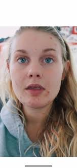 OLLY Flawless Complexion Gummies– OLLY PBC