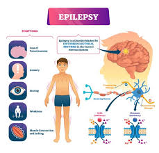Others may be able to decrease the frequency and intensity of their seizures by taking a combination of medications. Bringing Vital Epilepsy Care Directly To Homeless People In The Community