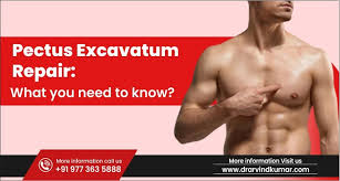 Image result for Pectus Excavatum