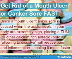 Home Remedies Hacks Tips And Tricks Lifetricks Canker Sore Mouth Ulcers Cankers