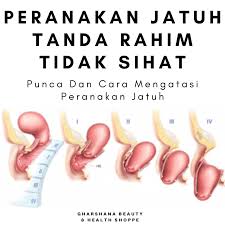 Anda ada masalah rahim jatuh atau tombong? Punca Dan Cara Gharshana Beauty Health Shoppe Facebook