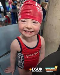 Positive About Down Syndrome