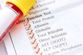 Image result for Liver Function Test