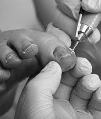 Get information, hours, photos, coupons, direct phone number and more on usa local guide. Dr Michael Scanlon Dpm Podiatrist In Kensington Brooklyn East Village Ny Foot Doctor In Kensington Brooklyn East Village Ny
